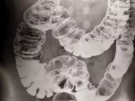 X-ray porn : le sexe vu de l'intérieur