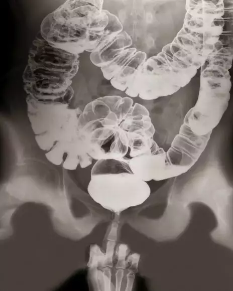 X-ray porn : le sexe vu de l'intérieur